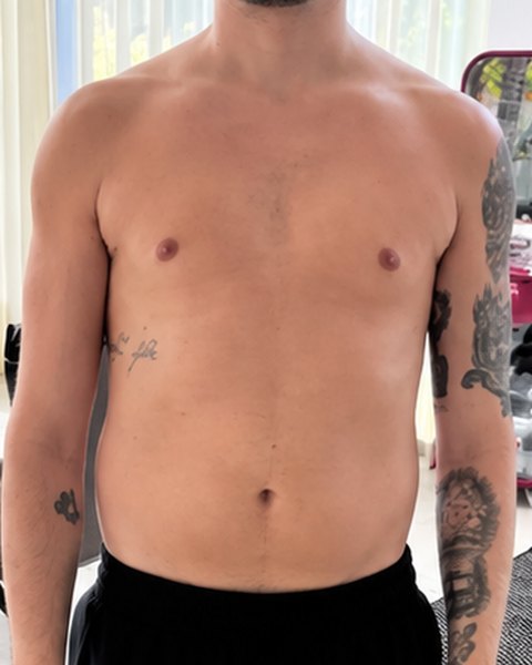 Client avant le coaching, torse de face